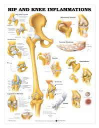 Hip and Knee Inflammations